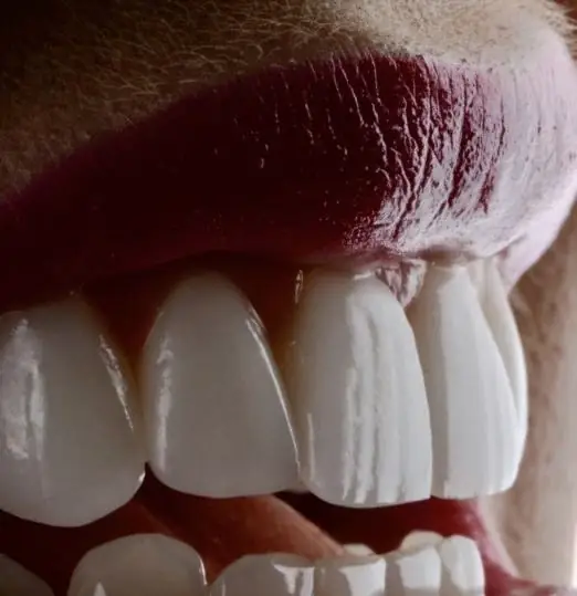 Detalhe de gengiva e dentes saudáveis